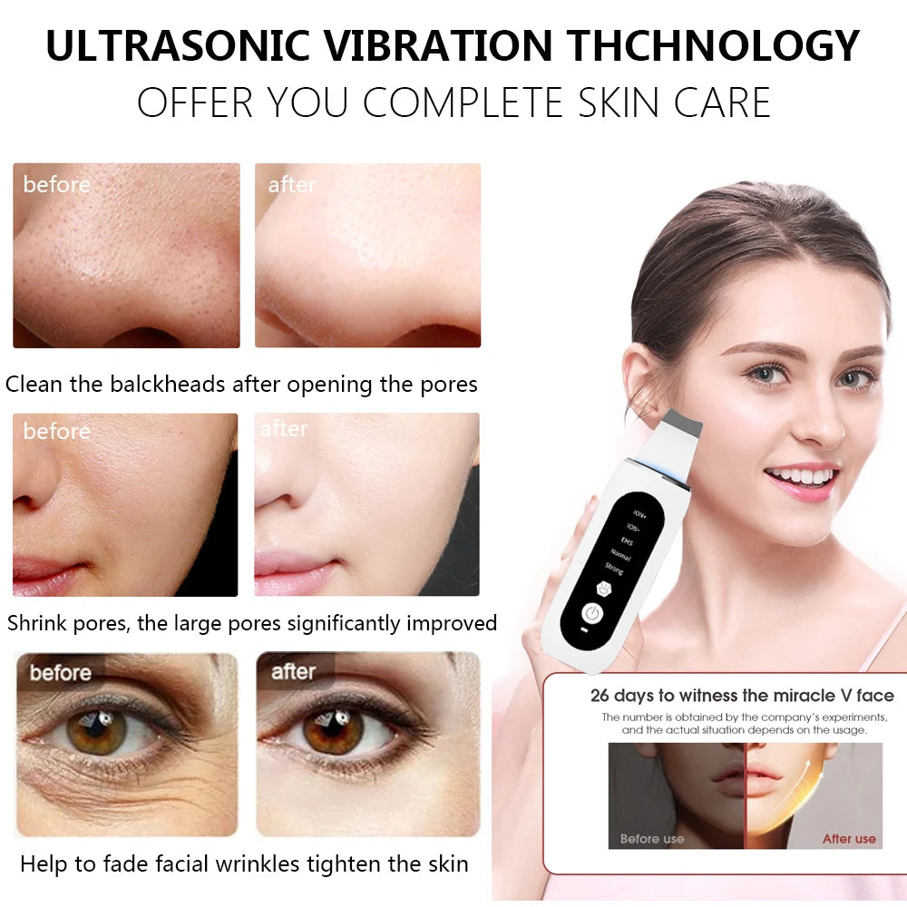 Skin Scrubber Facial Blackhead Remover